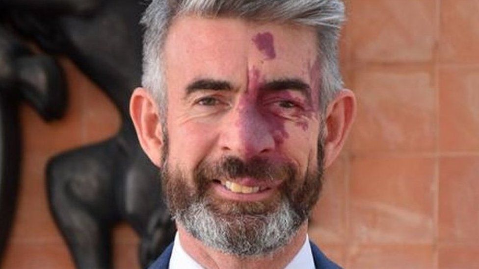 नेपालका लागि बेलायती पूर्वराजदूत मृत रुपमा भेटिए